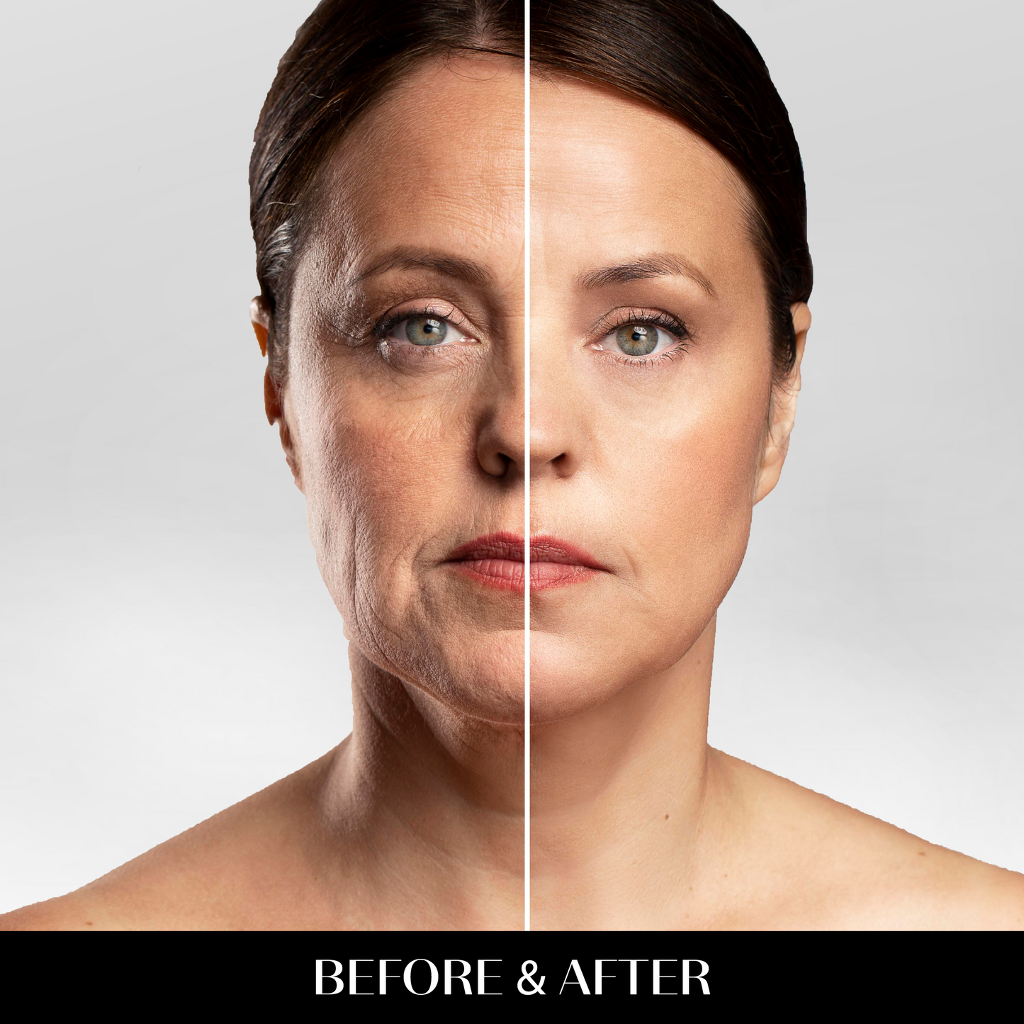 Aura™ EMS RED LIGHT THERAPY FACE NECK LIFT WRINKLE REMOVER