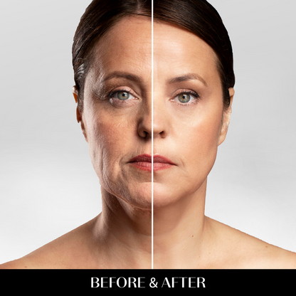 Aura™ EMS RED LIGHT THERAPY FACE NECK LIFT WRINKLE REMOVER